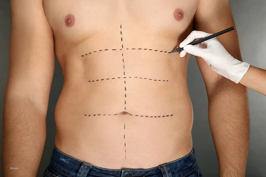 Daddy Makeover Surgery